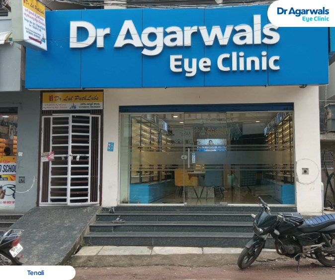 Tenali - Dr. Agarwal Eye Hospital