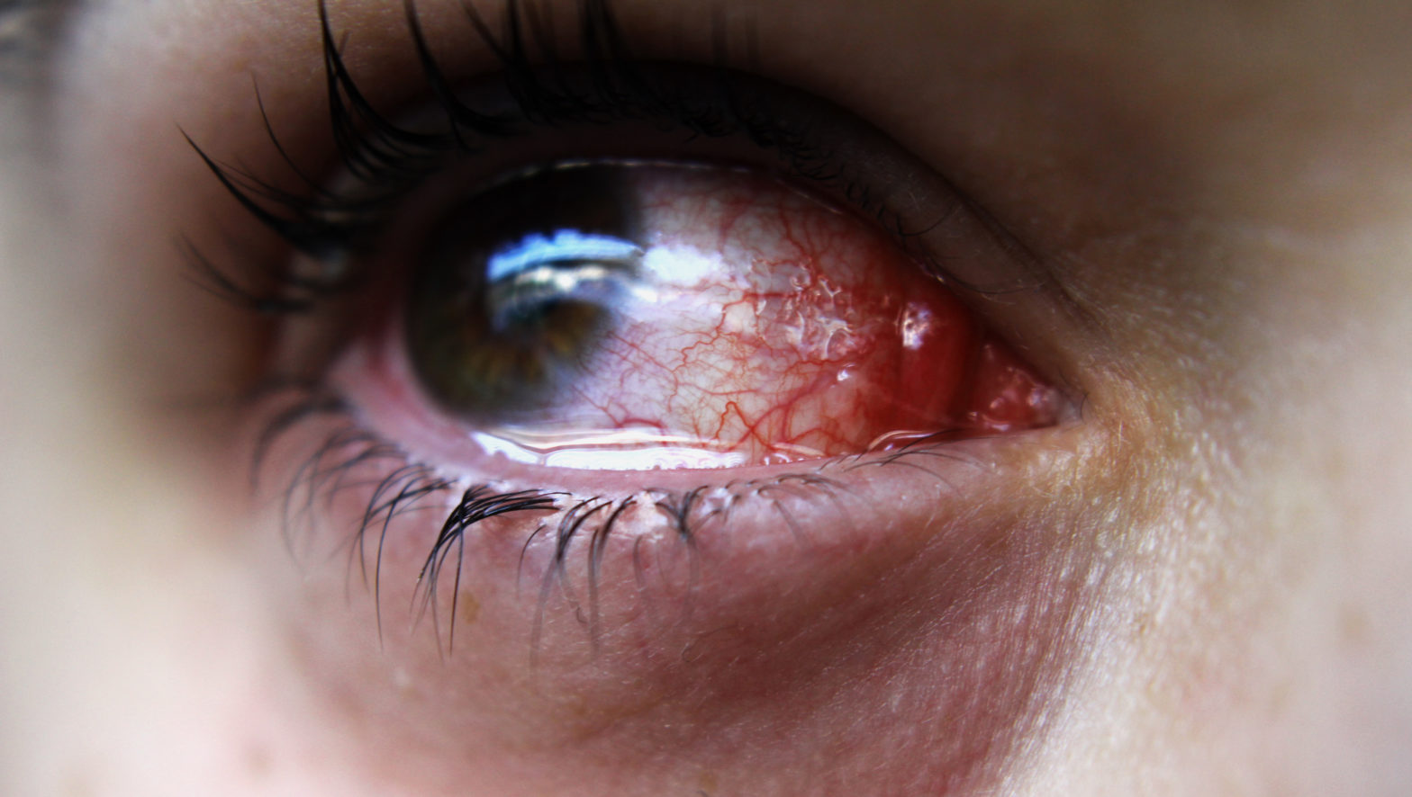 What Causes Watery Eyes? Common Factors Explained