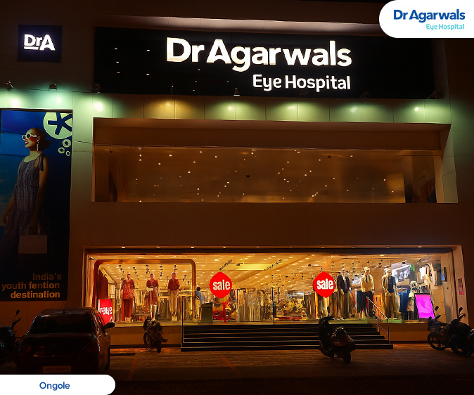 Ongole Exterior