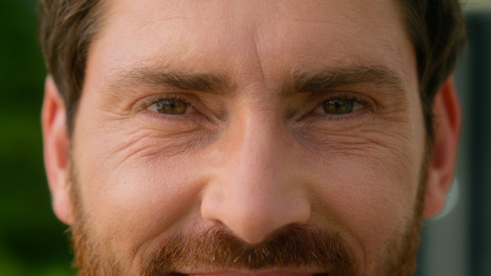 Effective Home Remedies for Under Eye Wrinkles That Truly Work