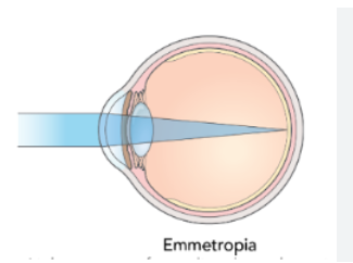 Emmetropia