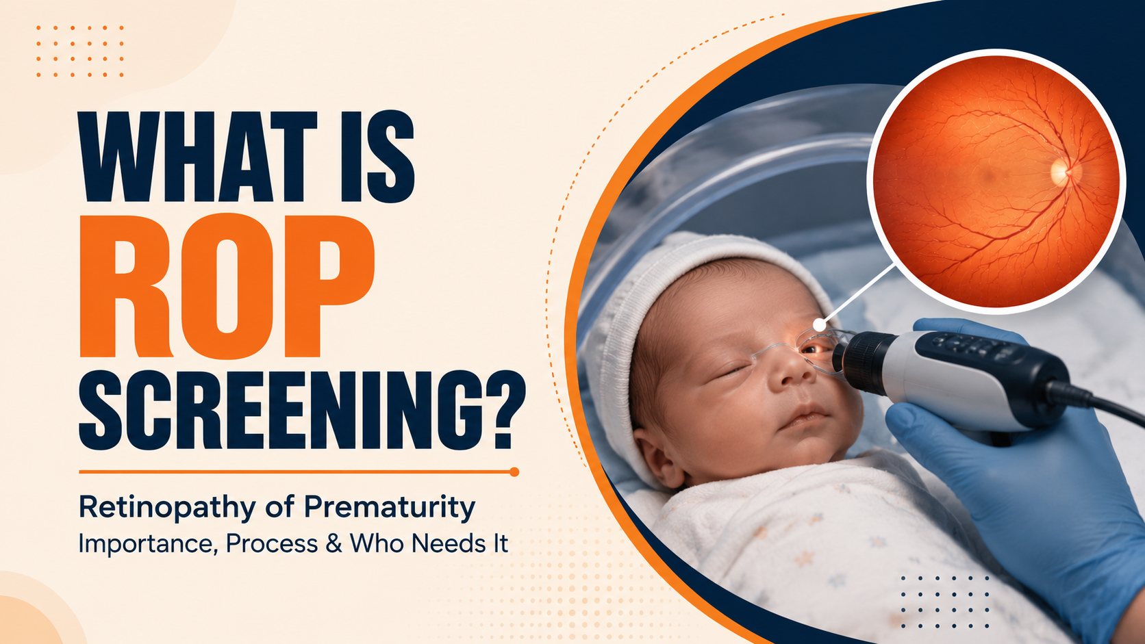 What Is ROP Screening