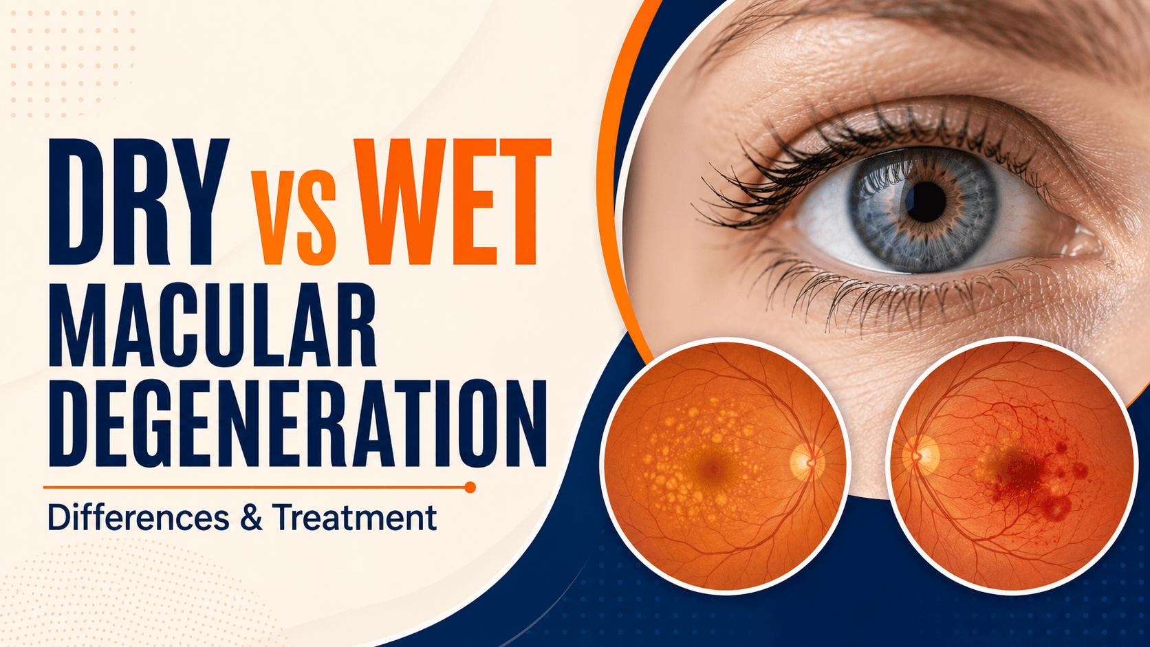 Dry vs Wet AMD