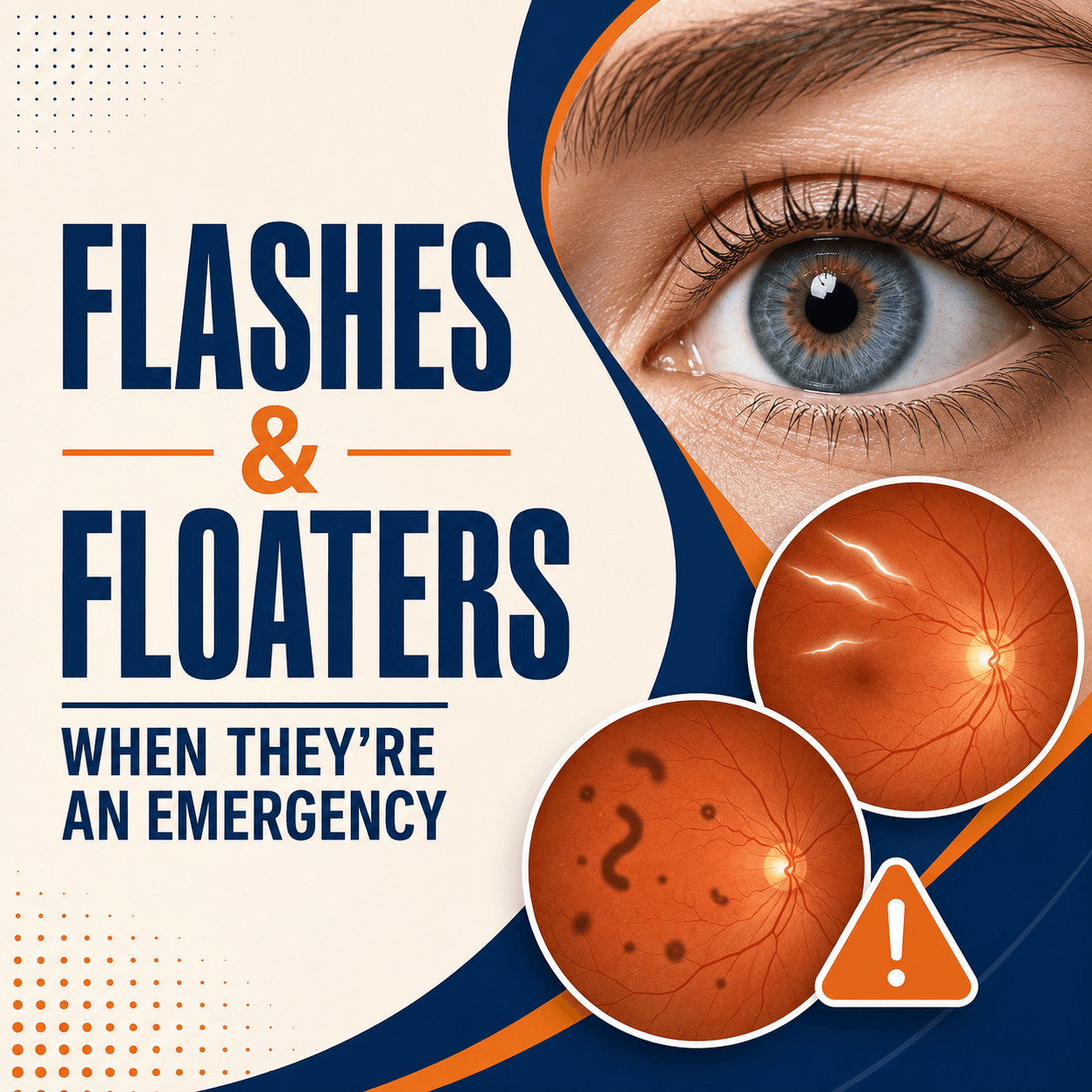 Flashes and Floaters
