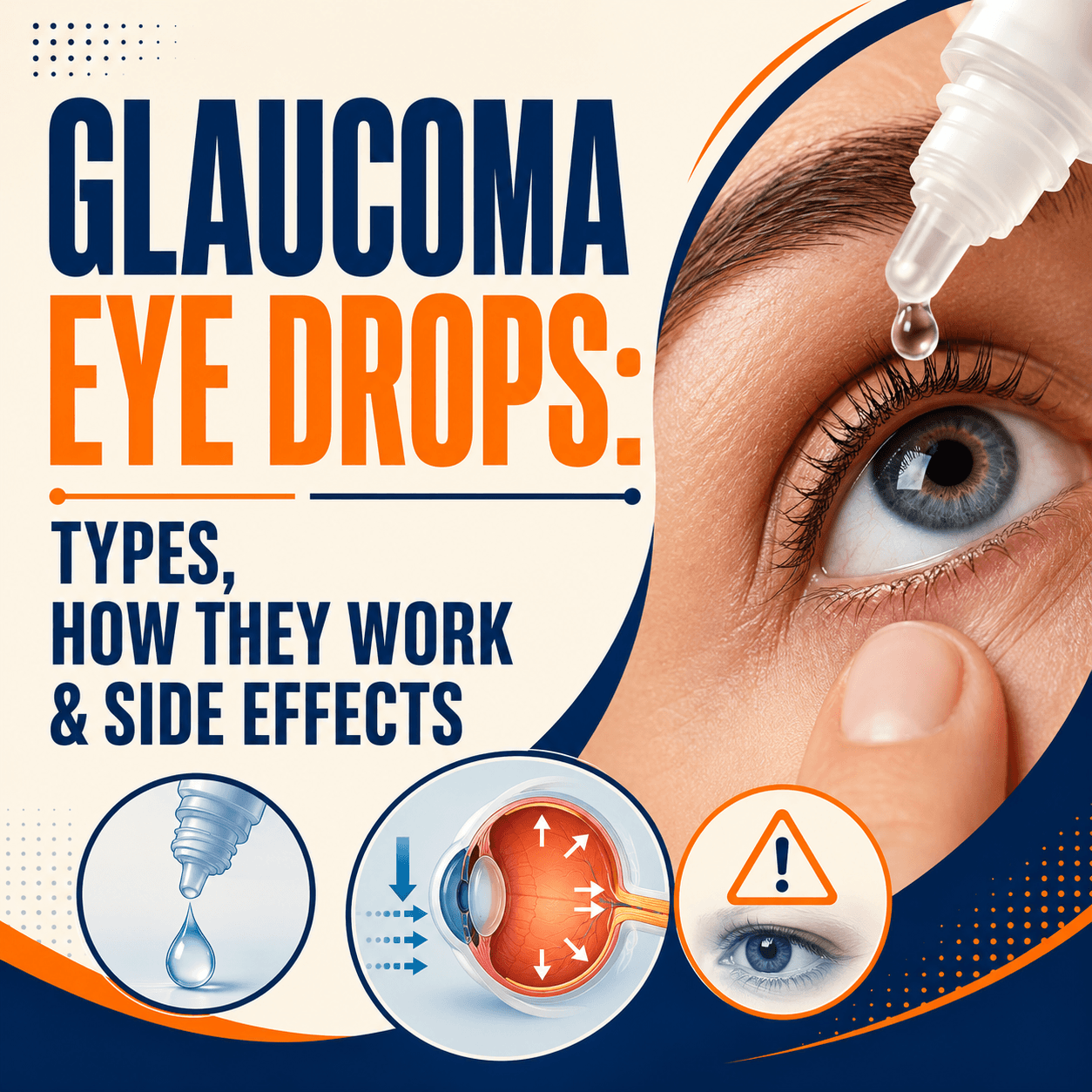 Glaucoma Eye Drops