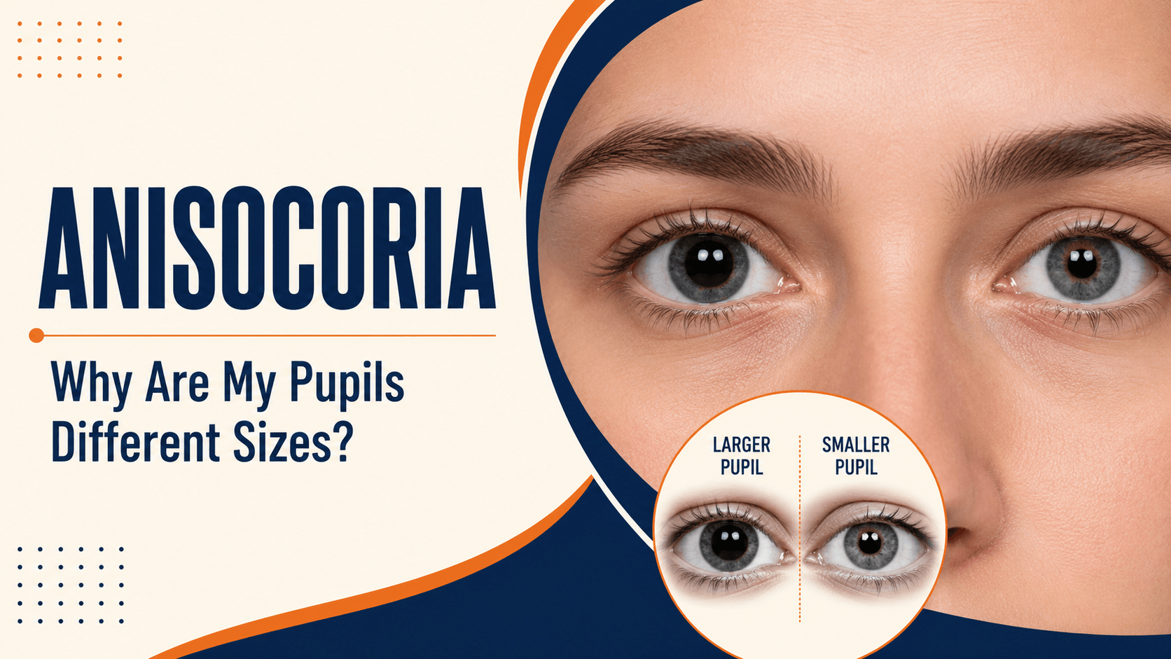 Anisocoria