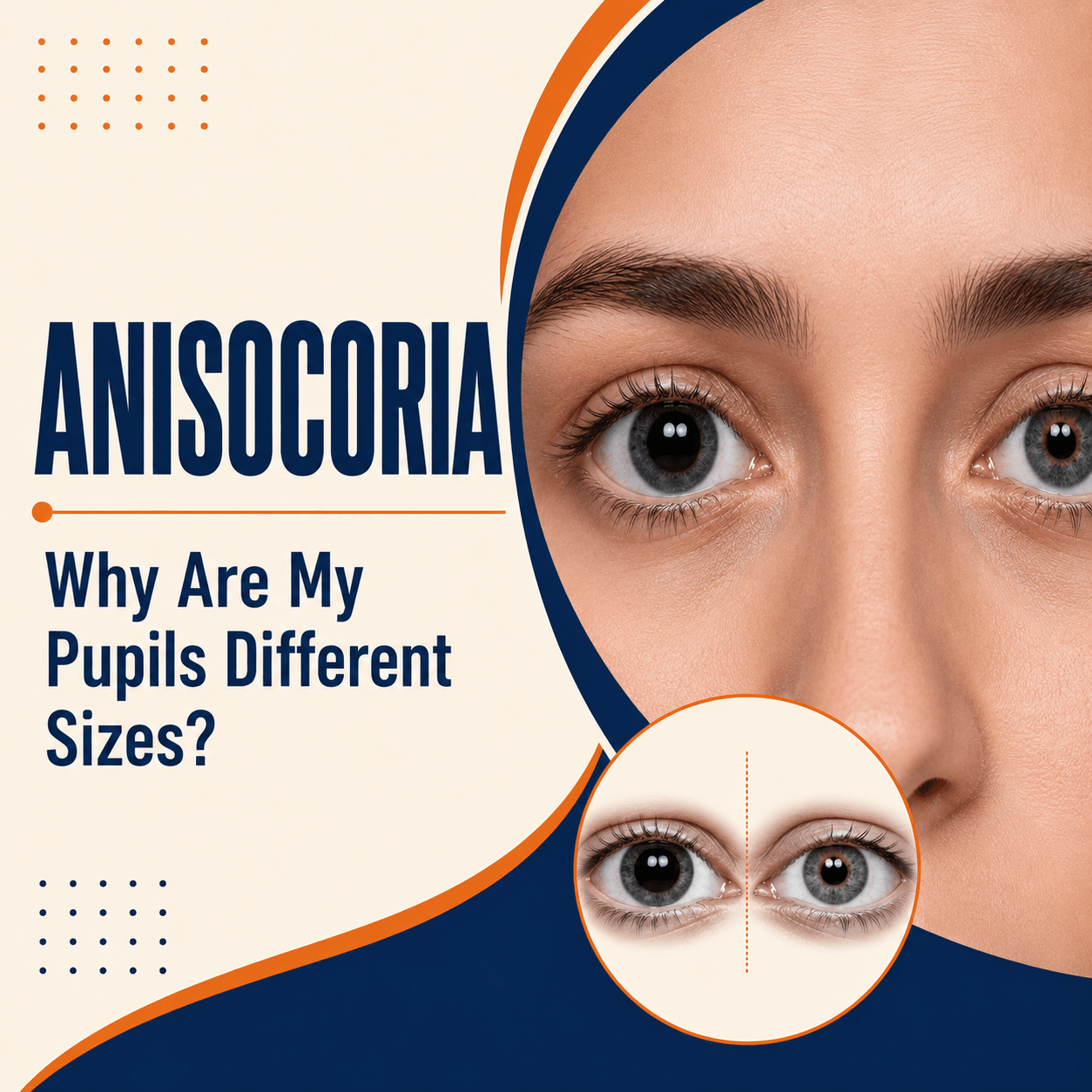 Anisocoria